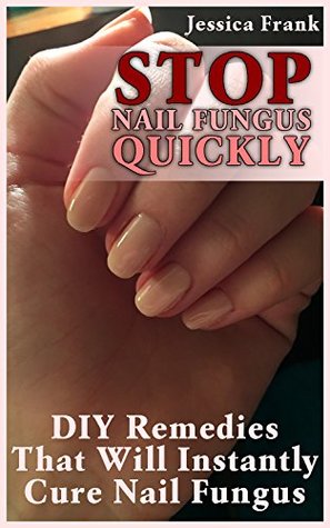 Full Download Stop Nail Fungus Quickly: DIY Remedies That Will Instantly Cure Nail Fungus - Jessica Frank file in PDF